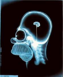 X-Ray of Homer Simpson's Head!